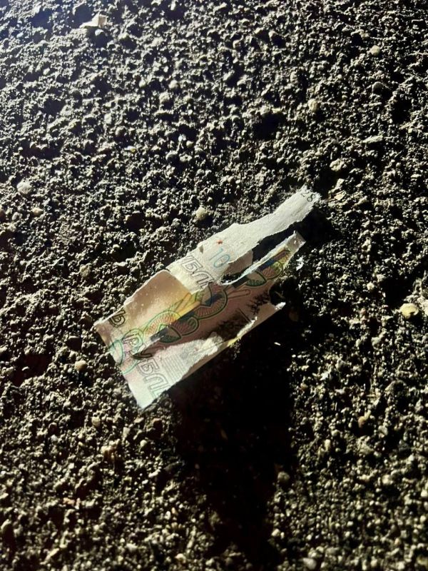 10-летний мальчик остался без пальцев, когда поднял деньги на улице в Подмосковье