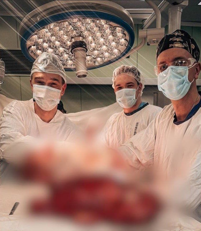 Огромную 13-килограммовую опухоль удалили пациенту хирурги в Краснодаре