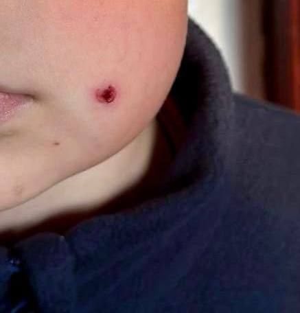 В Туапсе неизвестный выстрелил из пневматического ружья в 9-летнего мальчика