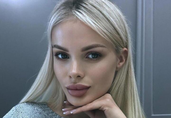 Избита зверски: модель с Кубани ее бойфренд едва не убил. Девушке сделали трепанацию черепа