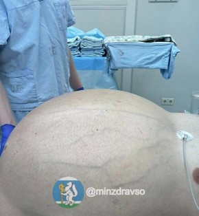 60-������������� ������� ������� � 50-������� �������� ����� ������������� ��������������