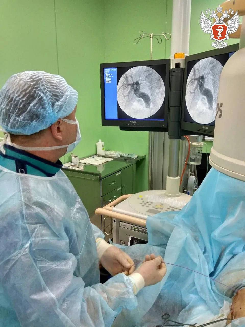 Врачи Краснодарского края удалили пациенту крупный желчный камень через небольшой прокол