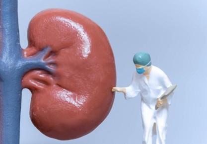 �������� ���� ��� ������ �������� �������