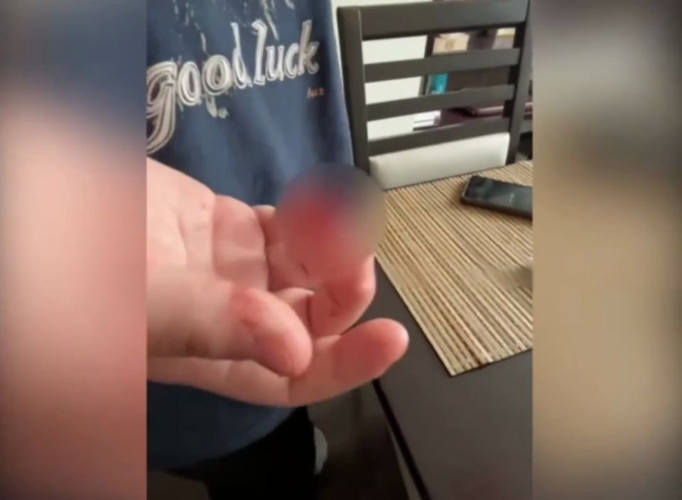 Девочка-подросток лишилась части пальца на квесте в Краснодаре