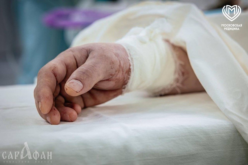 В Москве сделали то, что еще недавно казалось научной фантастикой – врачи впервые в России успешно пересадили руки пациентам, которые их лишились