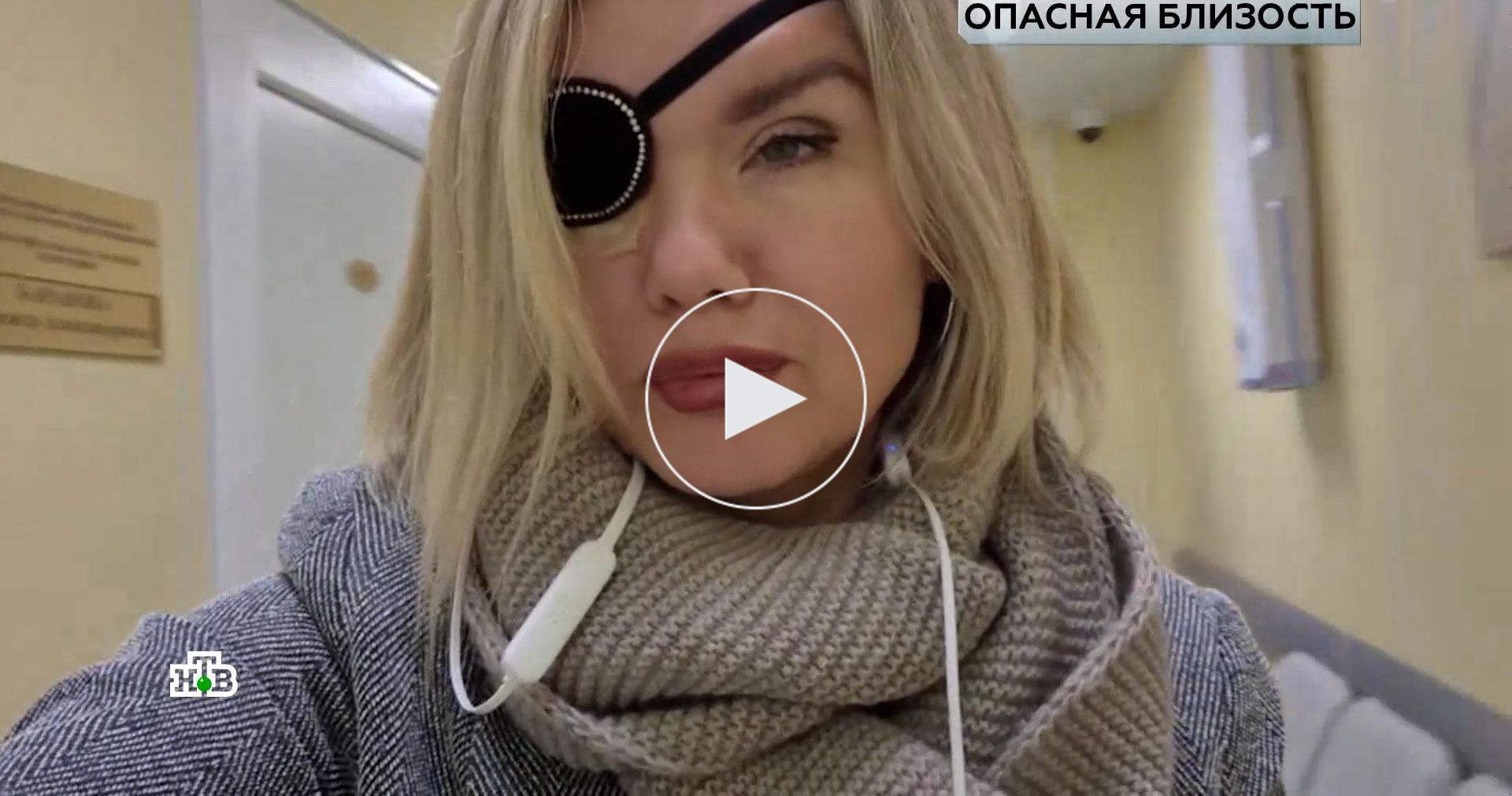 Сочи отвергнутый абьюзер выбил девушке глаз ключом от машины