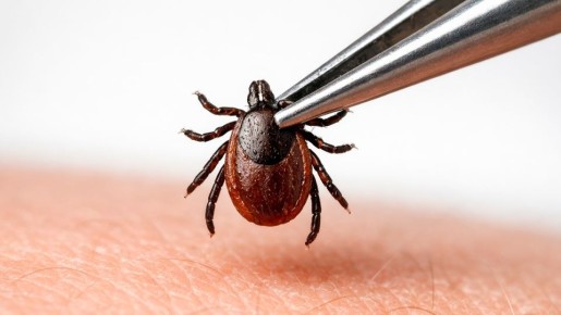 Роспотребнадзор перечислил регионы с наибольшим числом укусов клещей