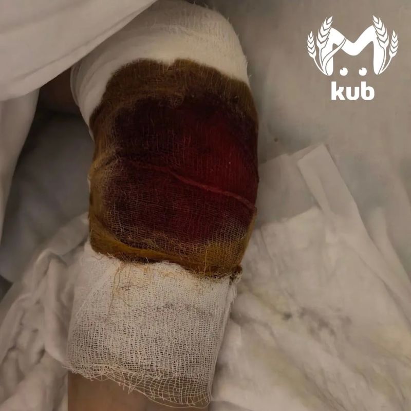 Пенсионер дважды переехал 9-летнюю девочку в Краснодаре и избежал уголовки