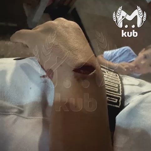 Бездомная собака напала на пятилетнего мальчика и протащила его по набережной в Анапе