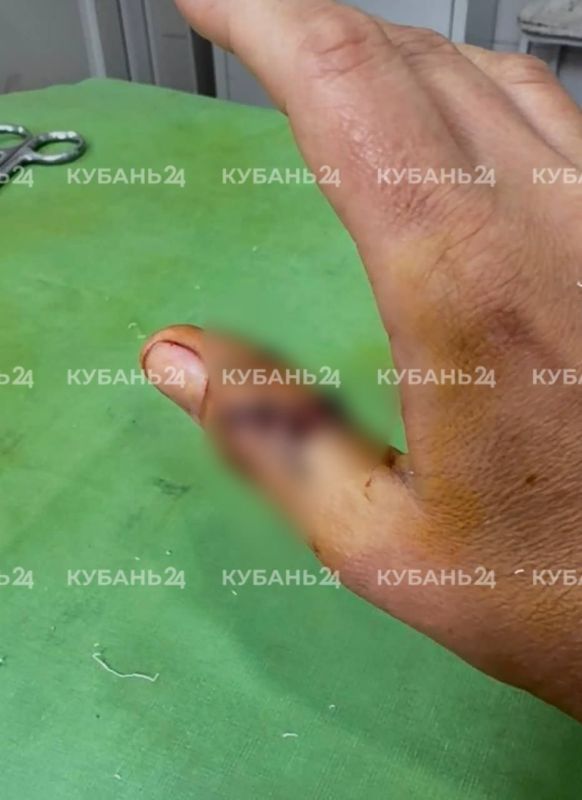 Пьяный сосед порезал бритвой руки женщины и ее мужа в Краснодаре