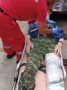 Коварная «грибная охота»: в Сочи спасатели на носилках вынесли из леса мужчину со сломанной ногой